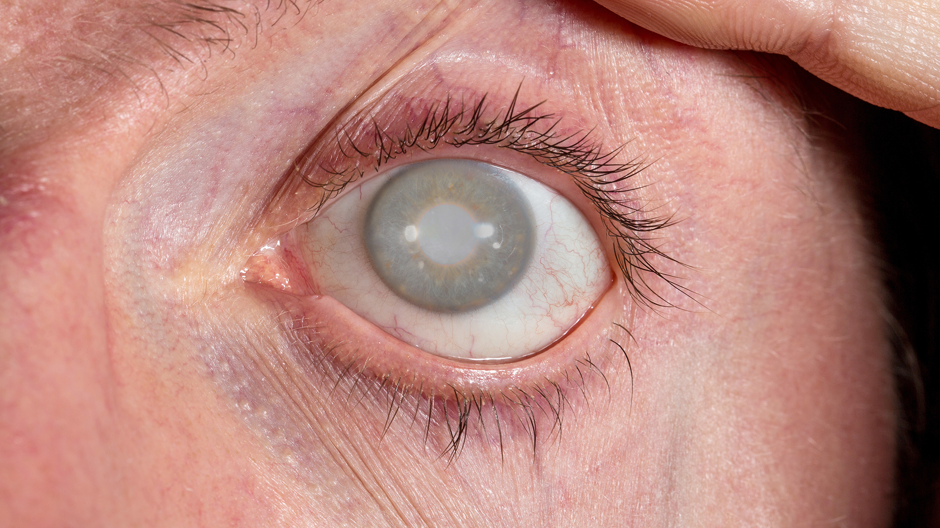 foto fundus