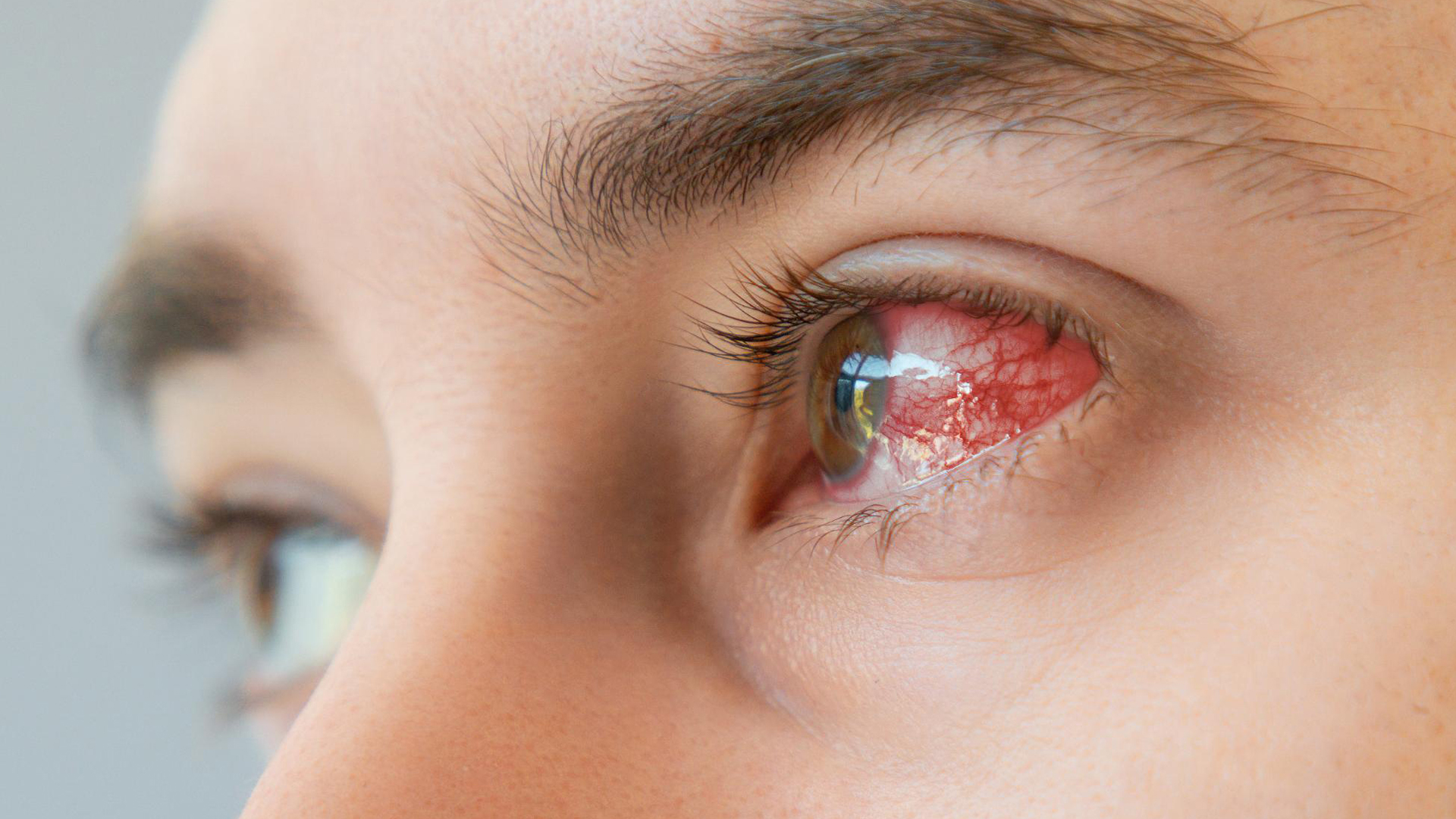 foto fundus